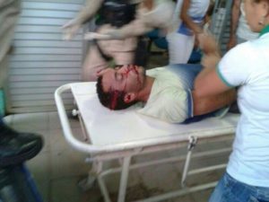 Valdonilson Rodrigues Nogueira, 27 anos, O Vodol