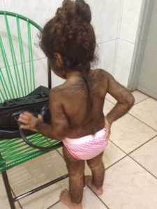 Apenas as palmas das mãos e os pés  não apresentam pêlos