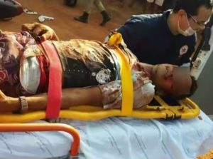 Assaltante foi atingido no olho