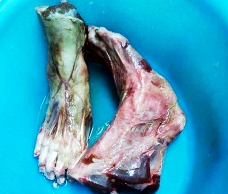 Restaurante é fechado após suspeita de servir carne humana nos seus pratos