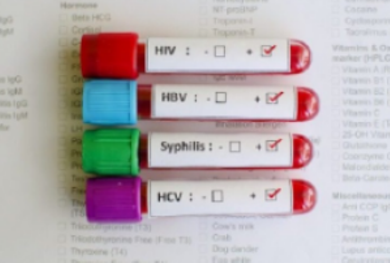 Infecções Sexualmente Transmissíveis, um perigo nem sempre visível